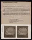 Cranio-Cerebral Topography - no. 9